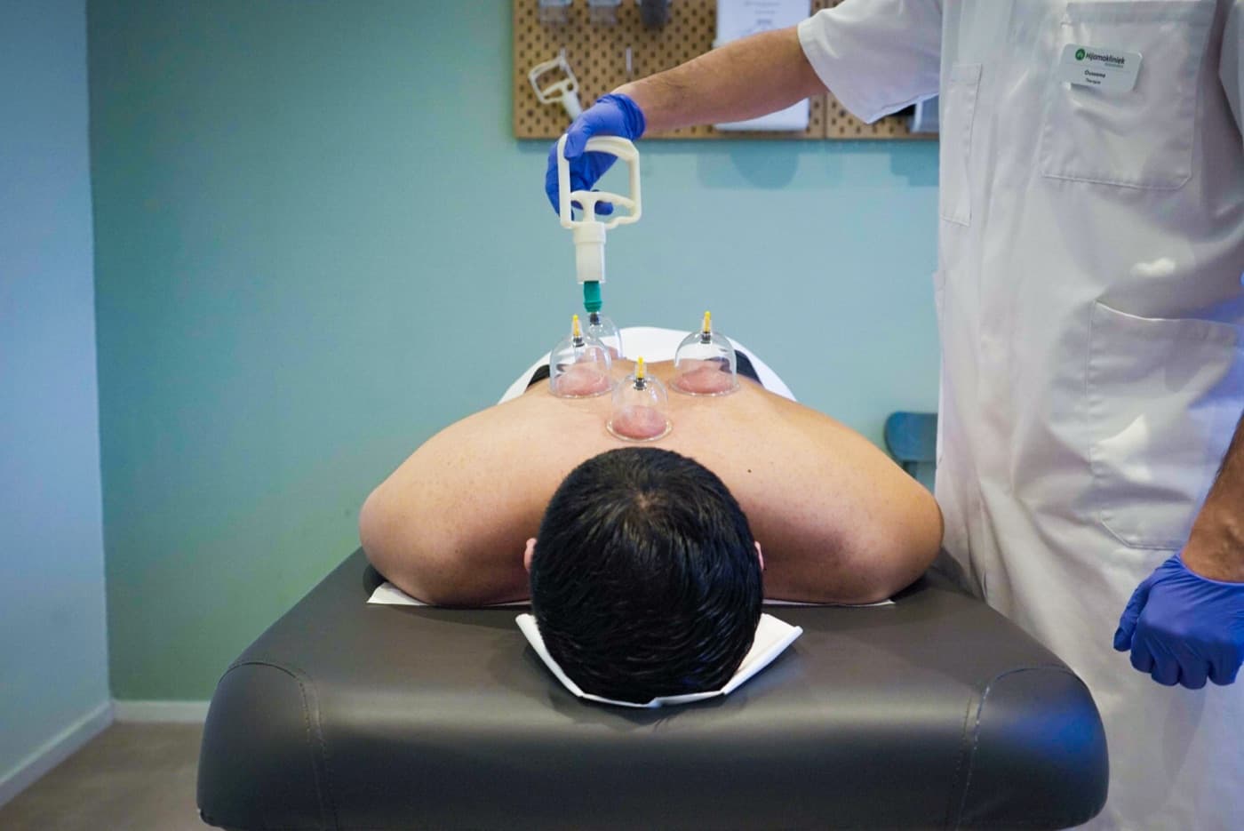 Hijama-behandeling op de rug